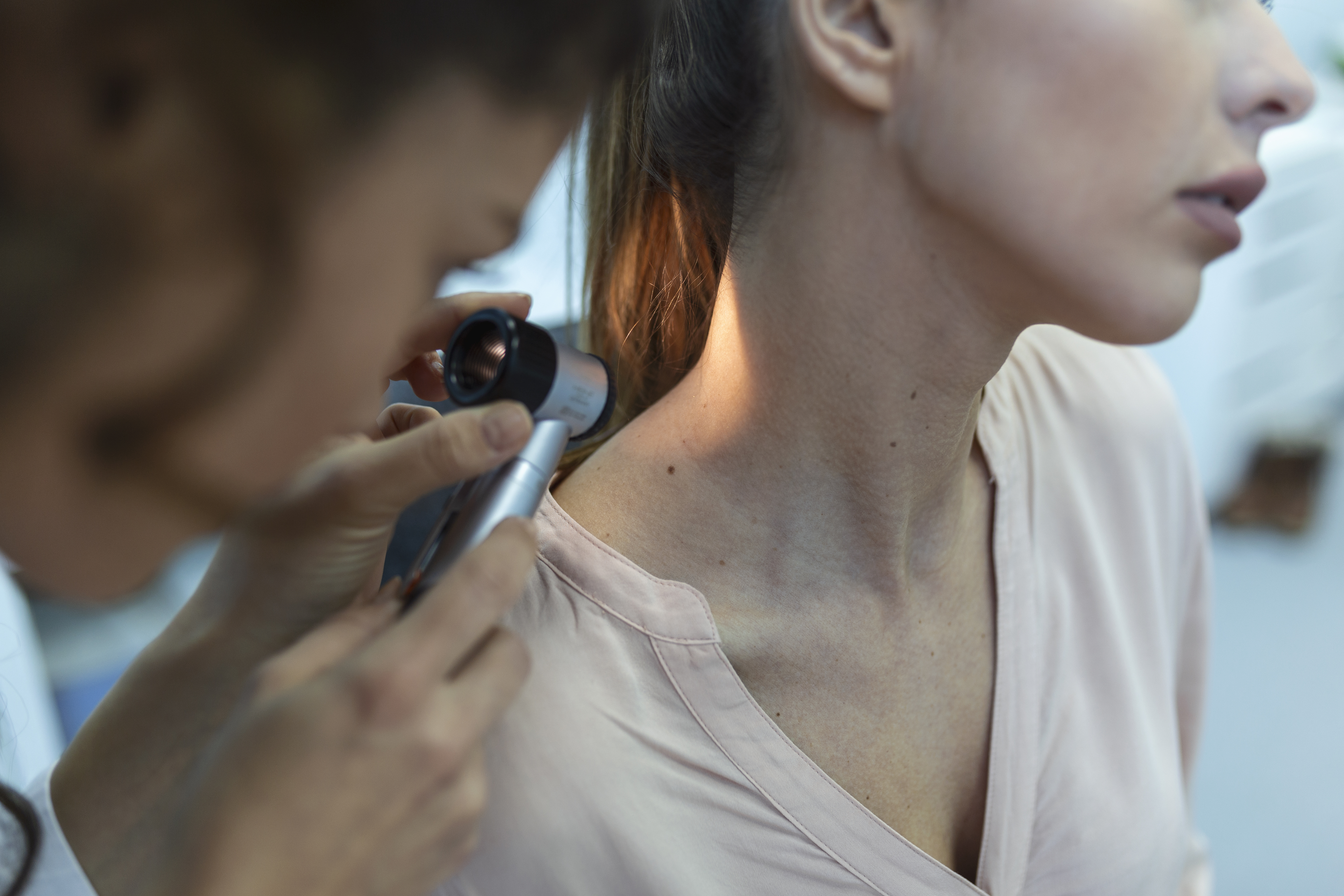 Cáncer de piel, prevención del cáncer más común en el mundo